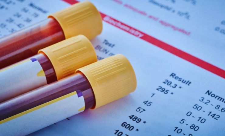 provette del sangue e risultati analisi